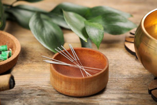 Acupuncture Therapy in Rishikesh