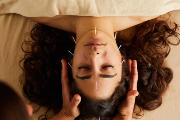 Acupuncture Therapy in Tapovan, Rishikesh